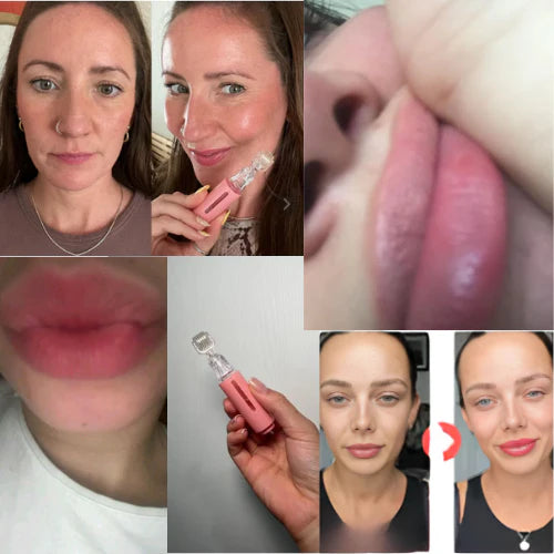 Liplush™ LipBoost Kit