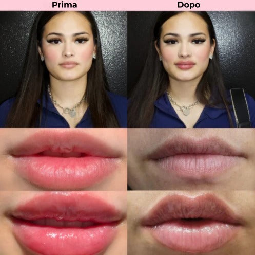 Liplush™ LipBoost Kit